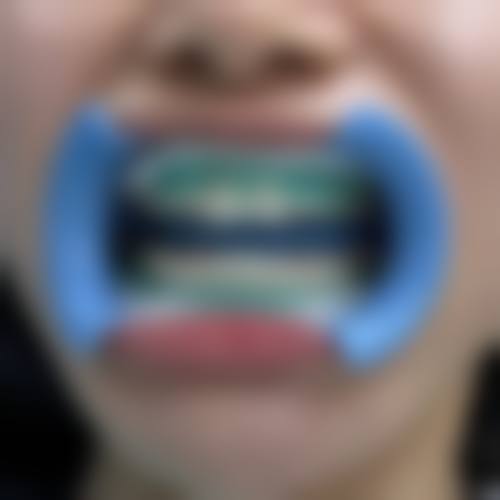 贵州贵阳龅牙兔口腔真人口碑评价怎么样？