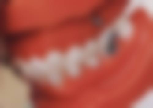 拔牙后多久可以正常吃饭