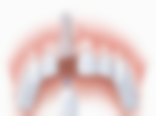 威兰德全瓷牙如何鉴别？从外观质地、官方查询及医院资质多方面为你解析鉴别方法