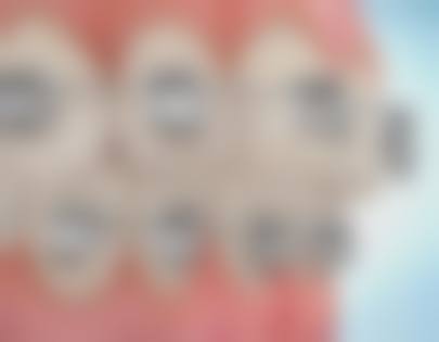 如何选择适合的矫正医院