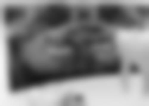 根管治疗之后牙疼之残髓炎