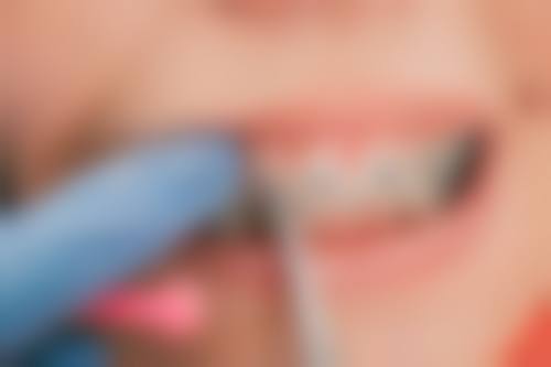 义乌嘉和口腔患者常见问题解答