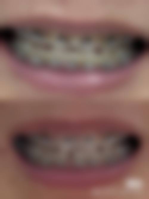 七、威海车峰口腔地址及交通路线