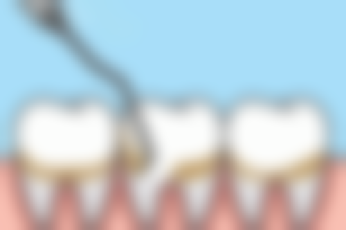 三、郑州市第二人民医院口腔颌面外科核心技术与诊疗优势