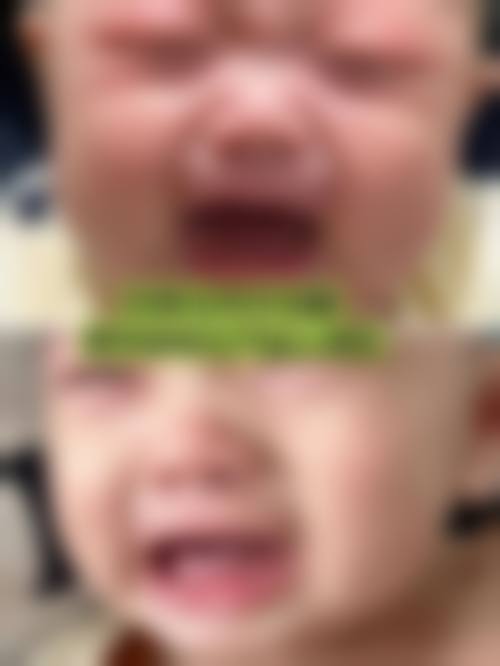 梅州儿牙医生24小时在线询问,太贴心了