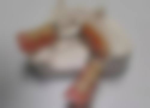 十四周岁的孩子可以补牙吗:推荐医院——北京大学口腔医院