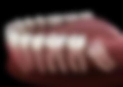 拔牙第二天能不能吃辣？医生提醒：吃辣易引发炎症，拔牙第二天千万别碰！ 