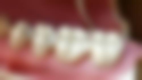 价格优势：实惠看牙不是梦