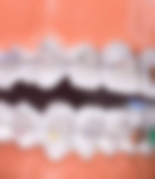 爱牙口腔根管治疗优势揭秘