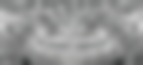 锦州镶假牙医生24小时在线咨询，亲测！解决我镶牙难题还省了不少钱 