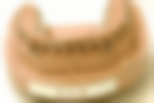 不建议自行拔牙的情况