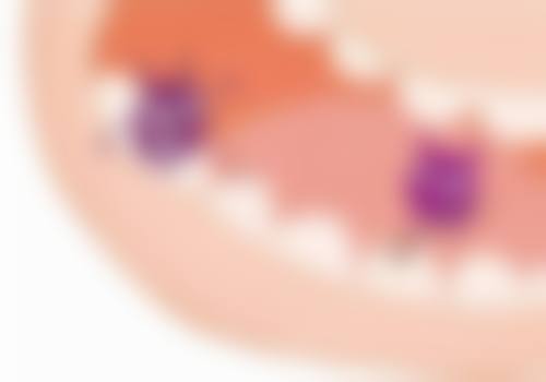 刚补牙后观察不适症状注意事项