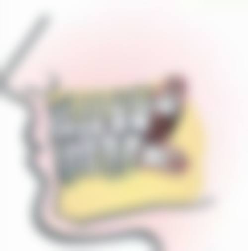 全瓷牙爱迪特的价格分析