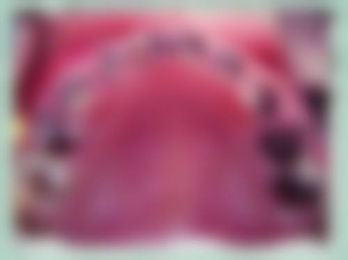 宜昌儿童牙科医生24小时在线询问：宝藏医院之宜昌市第二人民医院