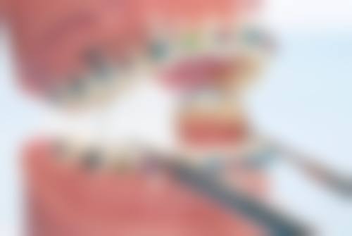 牙齿美白后其他方面的注意事项