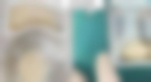 东莞长安镇种植牙医生24小时在线询问：深入了解机构