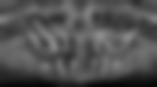 {东莞长安镇种植牙医生24小时在线咨询，我亲测后分享靠谱医院和实惠价格！ 