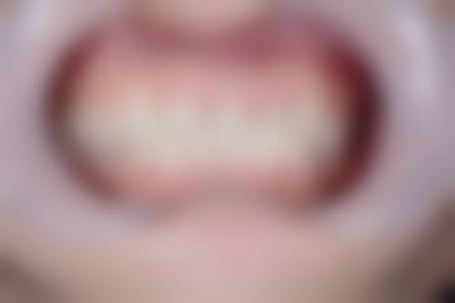 哈尔滨薄荷口腔门诊部医院特色技术及优质服务