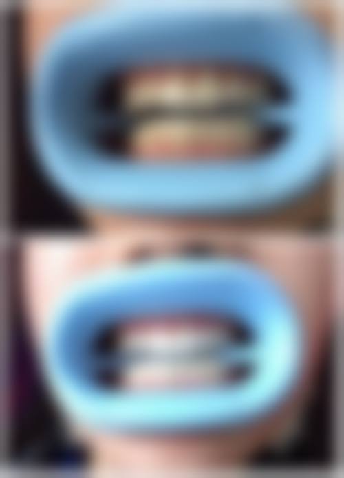 瓦房店爵冠口腔诊所真人口碑评价怎么样？