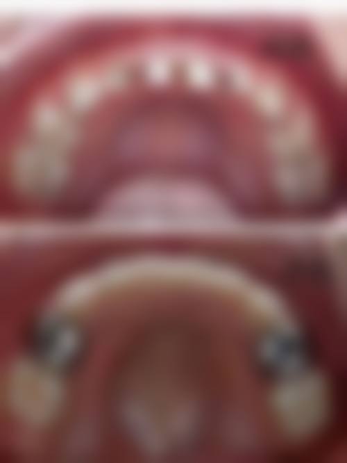 肇庆儿牙医生24小时在线咨询，我深夜为娃牙疼求助，竟收获超贴心诊疗建议！ 