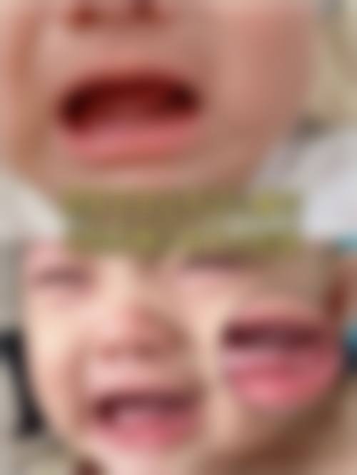 肇庆儿牙医生24小时在线询问:医院及医生的技术优势