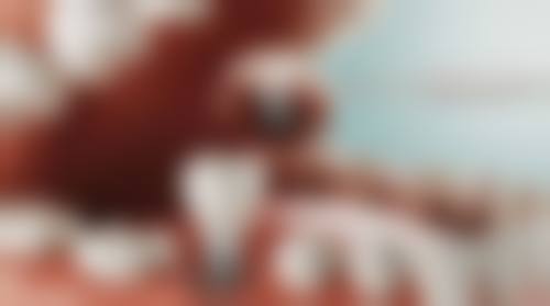 {晋城百年口腔门诊部在哪？在城区新市东街179号！种牙矫正价优，技术还靠谱！ 