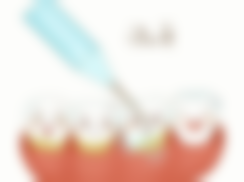 6岁孩子拔牙有危险吗？关键看牙齿状态与操作专业性，复杂情况需医生评估