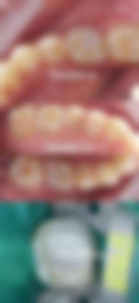 常熟24小时牙科急诊情况