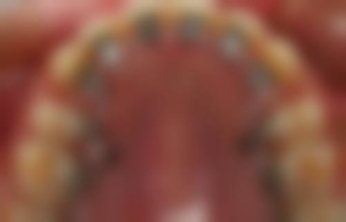 {东莞社保定点牙科医院有哪些？固德、莞口等多家医院补牙拔牙种牙均可刷社保卡！ 