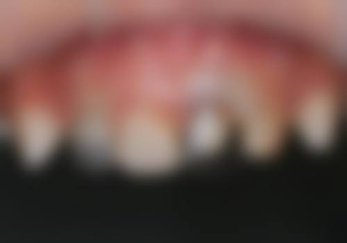 {嘉兴牙科医院在线咨询24小时，靠谱之选看这里！嘉诚口腔排名靠前，种牙、正畸性价比超高！ 