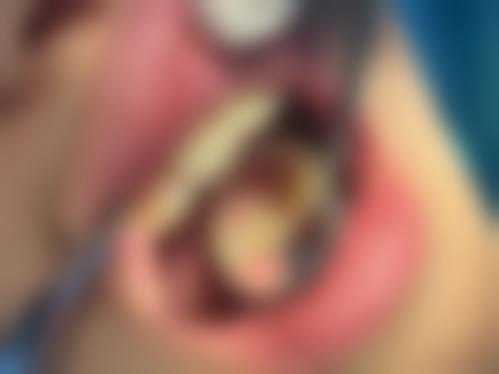 兴平兔博士口腔医院的技术实力优势