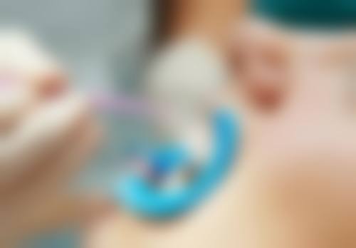 没洗过牙齿第一次洗牙需要注意什么？洗牙前后这些事项、洗牙方式及维护周期要记清 