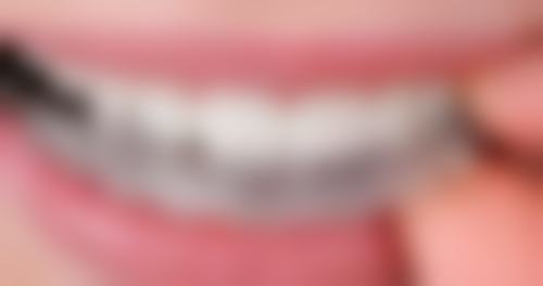 泰康拜博口腔的服务体验