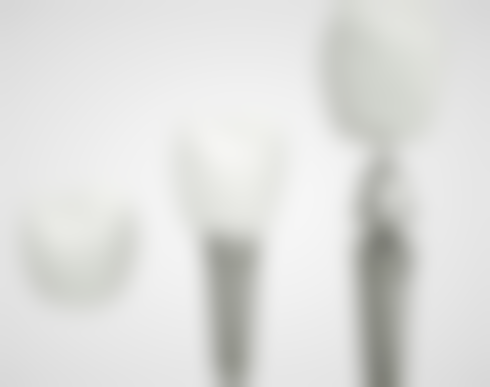 根管治疗弄出来黑色物质之清理的重要性