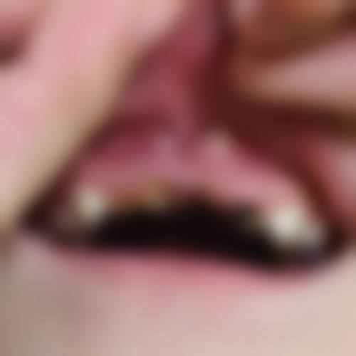 在线询问与选择医院的重要性