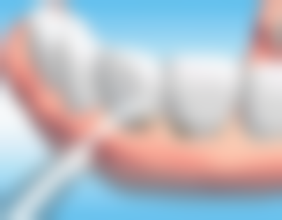 日常护理对补牙后牙齿使用时长的作用