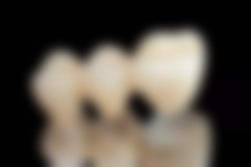 七旬老人种植牙的好处