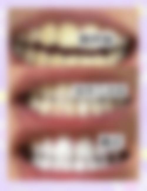 TOP5:衡阳欧亚协合口腔医院——精细矫正的贴心之选