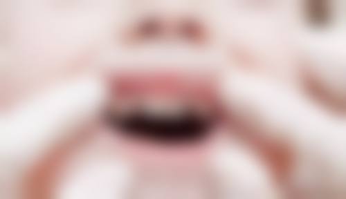 在线询问优势多，家长更放心