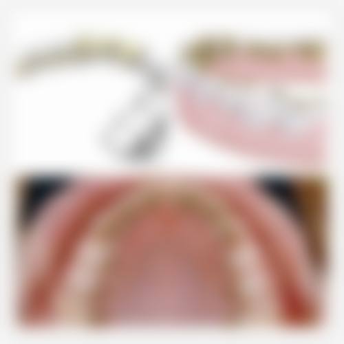 阿克苏牙齿矫正医生24小时在线询问：锁定心仪医生