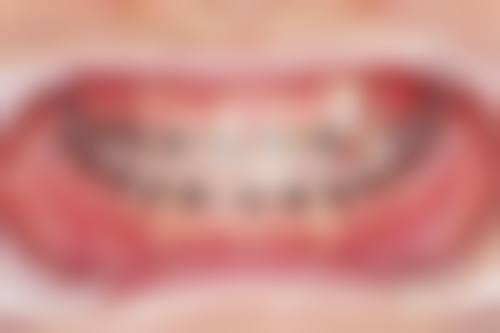 红河州博爱口腔——老牌口碑医院