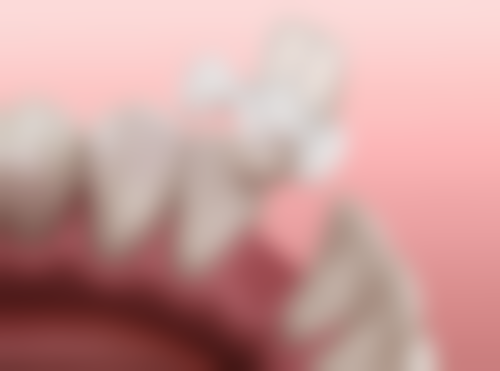 根管治疗填充物之生物相容性封闭剂