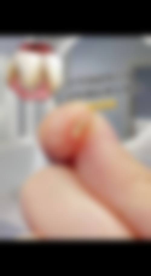 假牙护理与使用的注意事项