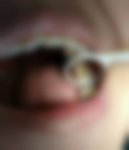 即拔即种：效率高种牙新体验