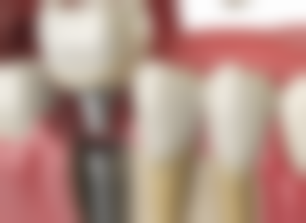 哪个牌子的洗牙器比较好？扉乐、洁碧、博皓等品牌值得关注！ 