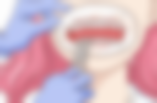 根管治疗的注意事项