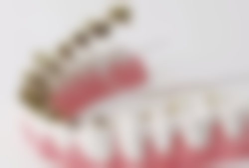 孝感牙髓炎患者的实例分享