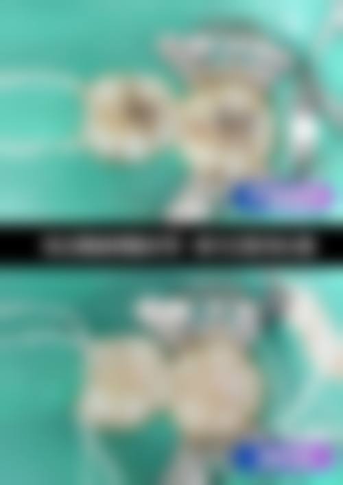 淄博补牙医生在线询问24小时：了解医生的实力