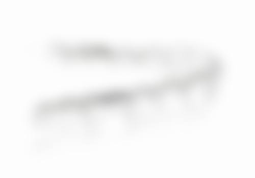 三、舌侧矫正（全舌侧）的治疗过程