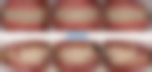 {南安口腔医院24小时在线咨询，前十机构种植牙2980起/矫正/补牙收费明细可查